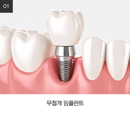 무절개 임플란트